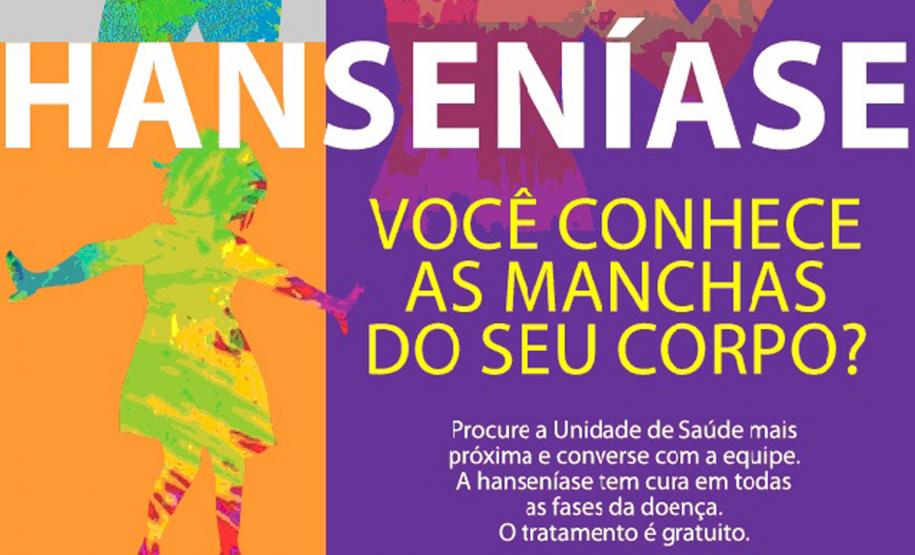 Tratamento para hanseníase é fornecido gratuitamente pelo SUS